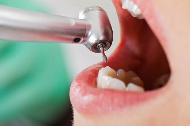 Best Emergency Broken Tooth Repair in Kemah, TX